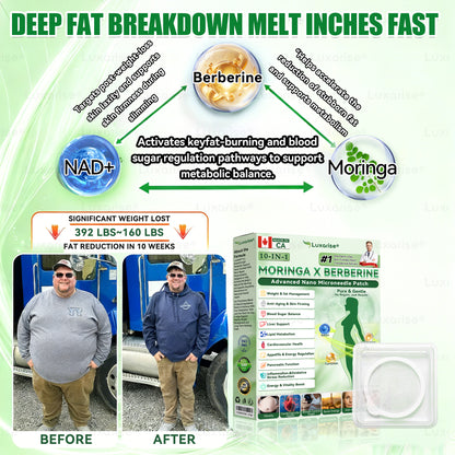 𝗟𝘂𝘅𝗮𝗿𝗶𝘀𝗲® 𝗢𝗳𝗳𝗶𝗰𝗶𝗮𝗹 𝗦𝘁𝗼𝗿𝗲 | 𝗠𝗼𝗿𝗶𝗻𝗴𝗮 & 𝗕𝗲𝗿𝗯𝗲𝗿𝗶𝗻𝗲 𝟭𝟬-𝗜𝗡-𝟭 𝗔𝗱𝘃𝗮𝗻𝗰𝗲𝗱 𝗡𝗮𝗻𝗼 𝗠𝗶𝗰𝗿𝗼𝗻𝗲𝗲𝗱𝗹𝗲 𝗣𝗮𝘁𝗰𝗵 🩹(𝗢𝗻𝗰𝗲 𝗮 𝗗𝗮𝘆 - 𝗩𝗶𝘀𝗶𝗯𝗹𝗲 𝗥𝗲𝘀𝘂𝗹𝘁𝘀 𝗶𝗻 𝗝𝘂𝘀𝘁 𝟳 𝗗𝗮𝘆𝘀) 🌿