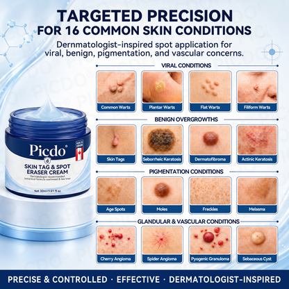 𝐏𝐡𝐚𝐫𝐦𝐚𝐜𝐢𝐬𝐭 𝐑𝐞𝐜𝐨𝐦𝐦𝐞𝐧𝐝𝐞𝐝 ✅𝐏𝐢𝐜𝐝𝐨® 7-𝐃𝐚𝐲 𝐒𝐤𝐢𝐧 𝐓𝐚𝐠 & 𝐒𝐩𝐨𝐭 𝐄𝐫𝐚𝐬𝐞𝐫 𝐂𝐫𝐞𝐚𝐦 🧴(Zero Pain, Zero 𝐒𝐜𝐚𝐫𝐬 Formula)💎