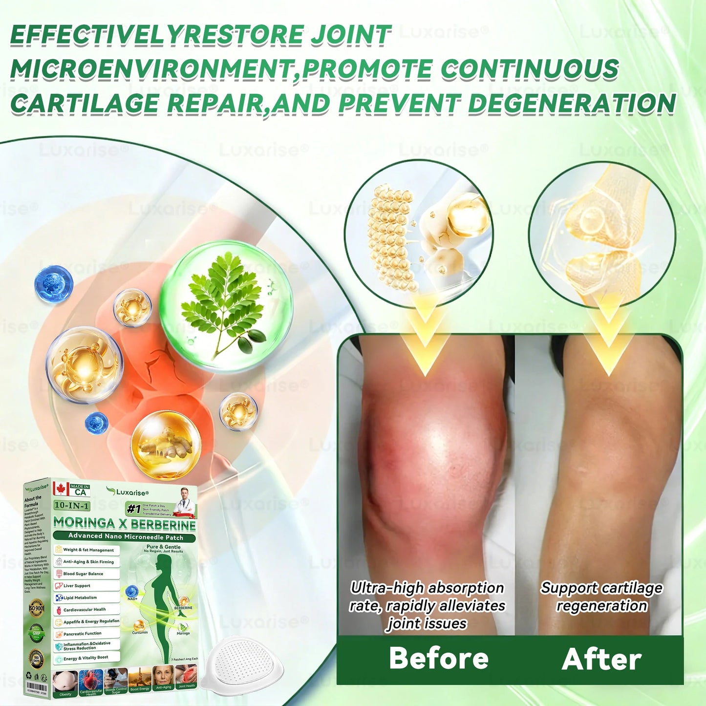 𝗟𝘂𝘅𝗮𝗿𝗶𝘀𝗲® 𝗢𝗳𝗳𝗶𝗰𝗶𝗮𝗹 𝗦𝘁𝗼𝗿𝗲 | 𝗠𝗼𝗿𝗶𝗻𝗴𝗮 & 𝗕𝗲𝗿𝗯𝗲𝗿𝗶𝗻𝗲 𝟭𝟬-𝗜𝗡-𝟭 𝗔𝗱𝘃𝗮𝗻𝗰𝗲𝗱 𝗡𝗮𝗻𝗼 𝗠𝗶𝗰𝗿𝗼𝗻𝗲𝗲𝗱𝗹𝗲 𝗣𝗮𝘁𝗰𝗵 (𝗢𝗻𝗰𝗲 𝗮 𝗗𝗮𝘆 - 𝗩𝗶𝘀𝗶𝗯𝗹𝗲 𝗥𝗲𝘀𝘂𝗹𝘁𝘀 𝗶𝗻 𝗝𝘂𝘀𝘁 𝟳 𝗗𝗮𝘆𝘀) 🌈